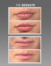 Load image into Gallery viewer, The Outset - Lip Oasisᵀᴹ Glossy Treatment